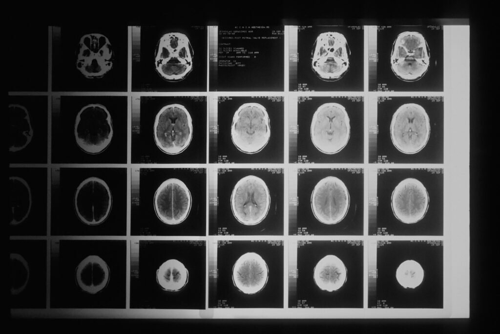 Sala presidente società europee neurochirurgia