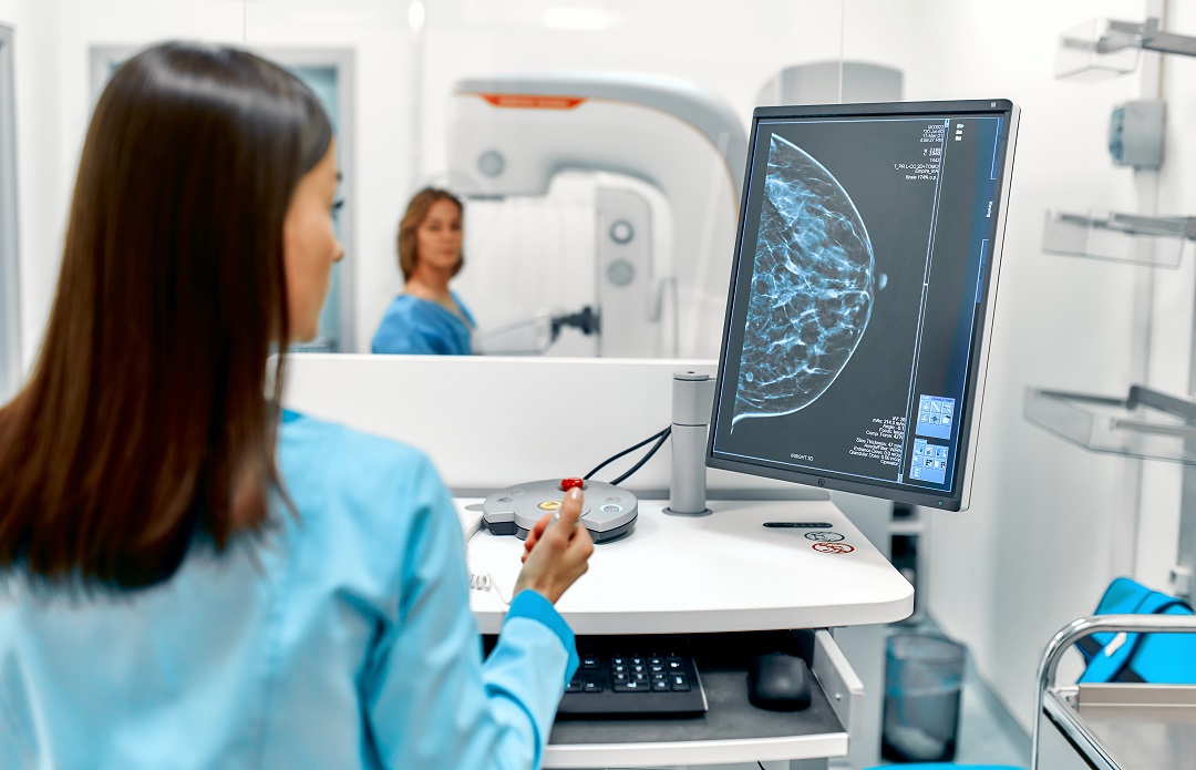 Ospedale di Legnago, stop ai tatuaggi nella radioterapia al seno grazie al 3D